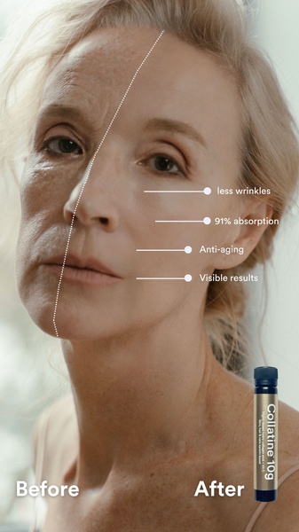 A split-screen comparison showing a woman's face with wrinkles labeled 'Before' and smooth skin labeled 'After', highlighting product benefits like absorption and anti-aging.